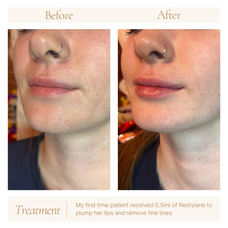 Neutral Before and After Instagram Post (1)