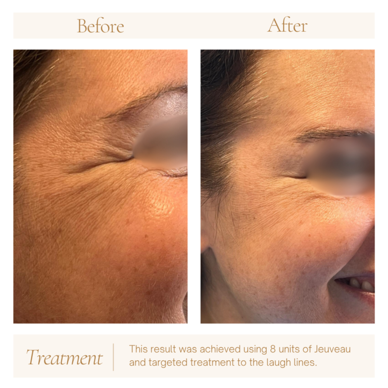 Neutral Before and After Instagram Post (3)